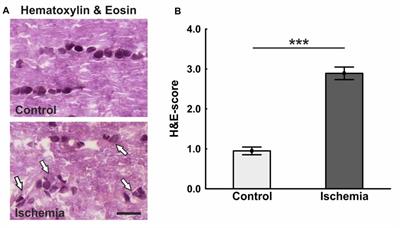 Optic Nerve Degeneration after Retinal Ischemia/Reperfusion in a Rodent Model